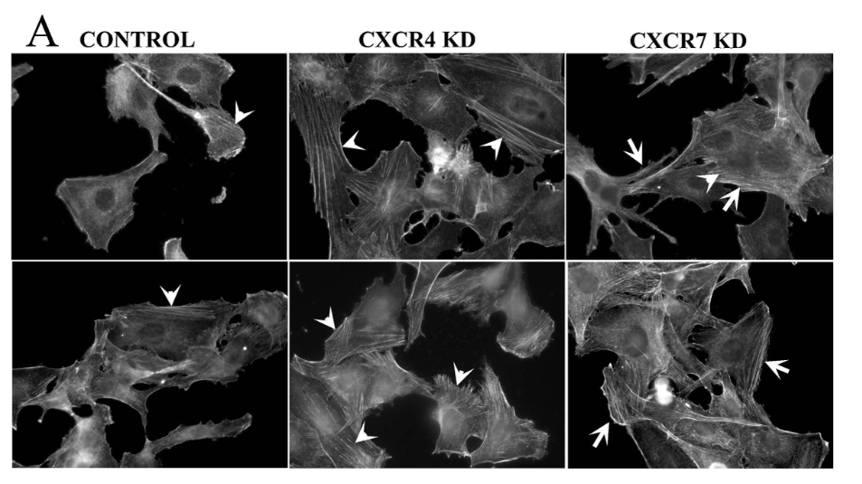 The Complementary Roles of CXCR4 and CXCR7 in Melanoma Migration